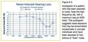 Noise-induced Hearing Loss graph