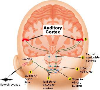 Direct Electrical Stimulation of the Brain for Tinnitus Relief