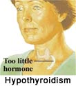 Thyroid Dysfunction and Tinnitus
