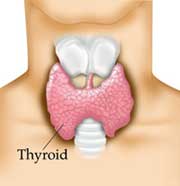 Thyroid Dysfunction and Tinnitus
