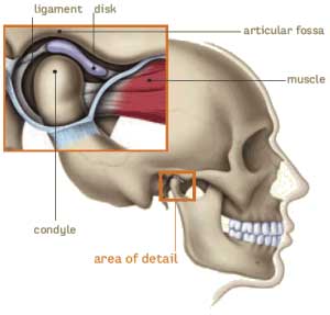 TMJ Dysfunction and Tinnitus