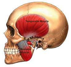 Bruxism, TMJ Disorder and Tinnitus