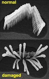 image of normal and damaged hair cells of the inner ear.