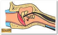 myoclonus-middle-ear